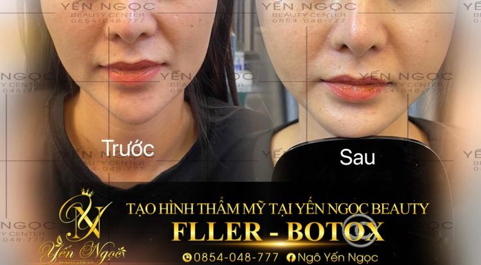 Hình ảnh đầu tiên của Ngọc Beauty Spa & Clinic