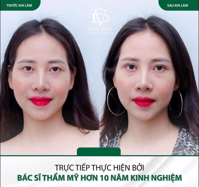 Hình ảnh thứ hai của Thẩm Mỹ Quốc Tế Việt Đức