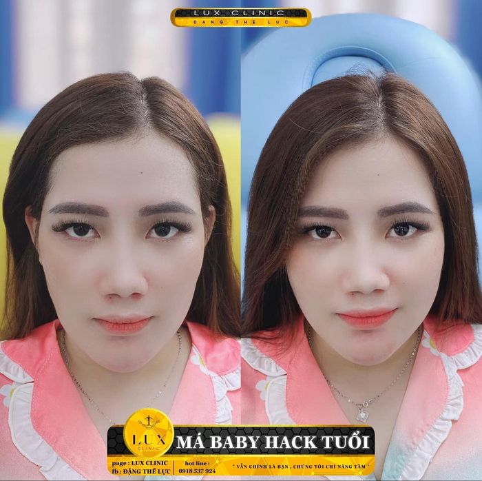 Lux Clinic Spa - Hình ảnh 2