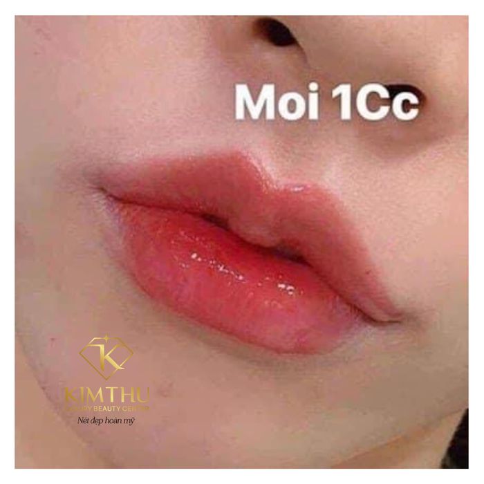 Hình ảnh Thẩm Mỹ Thu Kim 2