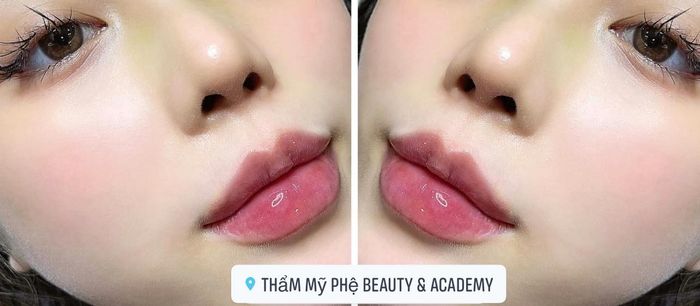 Ảnh 1 của Phệ Beauty & Academy