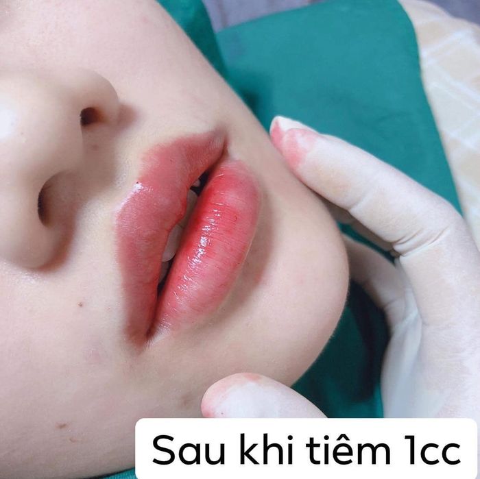 LinhAnh BeautyCenter hình ảnh 1