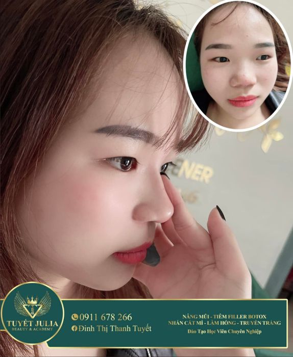 Hình ảnh thứ hai của Thẩm Mỹ Viện Tuyết Julia