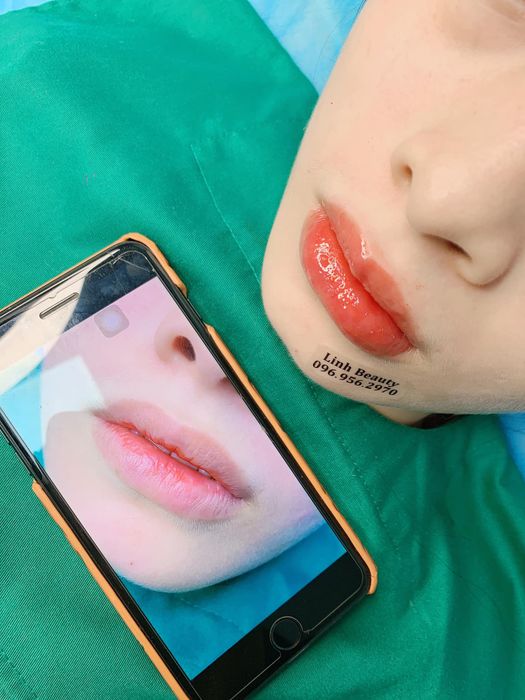 Ảnh 1 của Thuỳ Linh Beauty & Clinic
