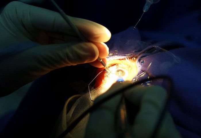 Khoa Mắt tại Bệnh viện Đa khoa tỉnh Quảng Ninh - Hình 2