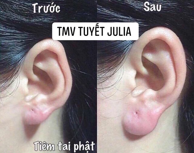 Hình ảnh đầu tiên của Thẩm Mỹ Viện Tuyết Julia