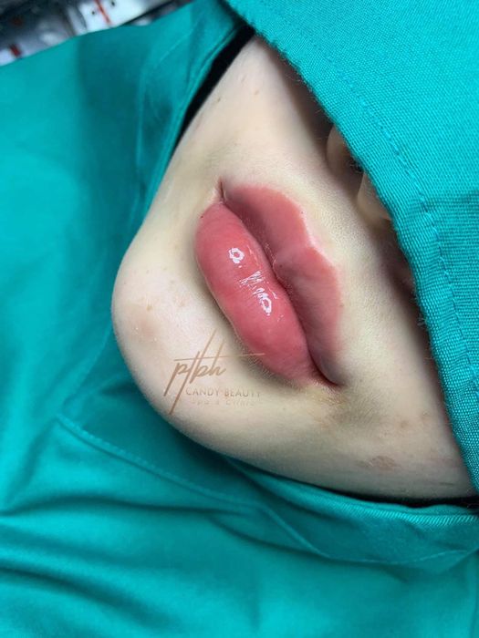 Viện Thẩm Mỹ Hiền Phan hình ảnh 1