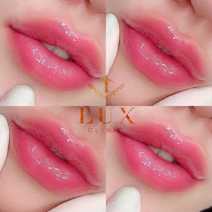 Lux Clinic Spa - Hình ảnh 1