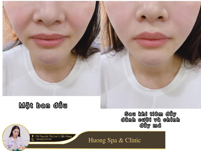 Hình ảnh thứ hai tại Hương Spa & Clinic