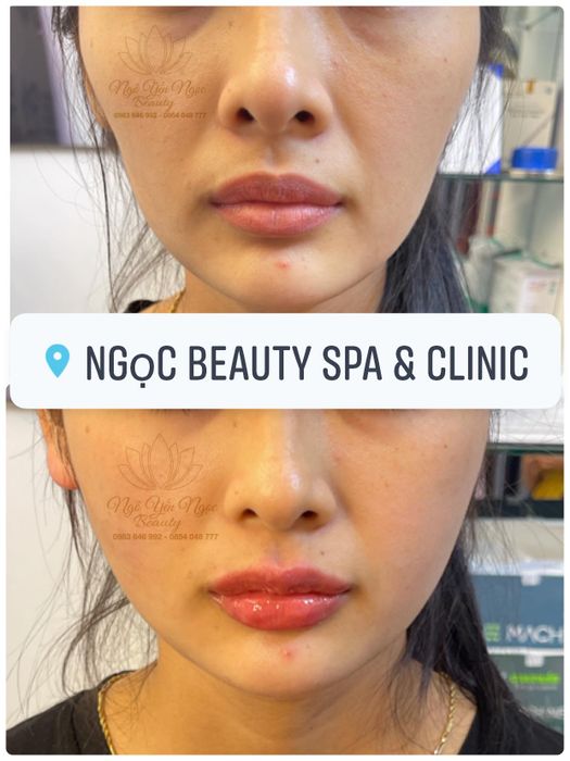 Hình ảnh thứ hai của Ngọc Beauty Spa & Clinic