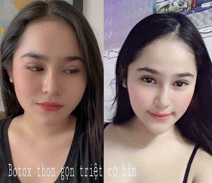 Duyên Beauty Spa & Clinic hình ảnh 2