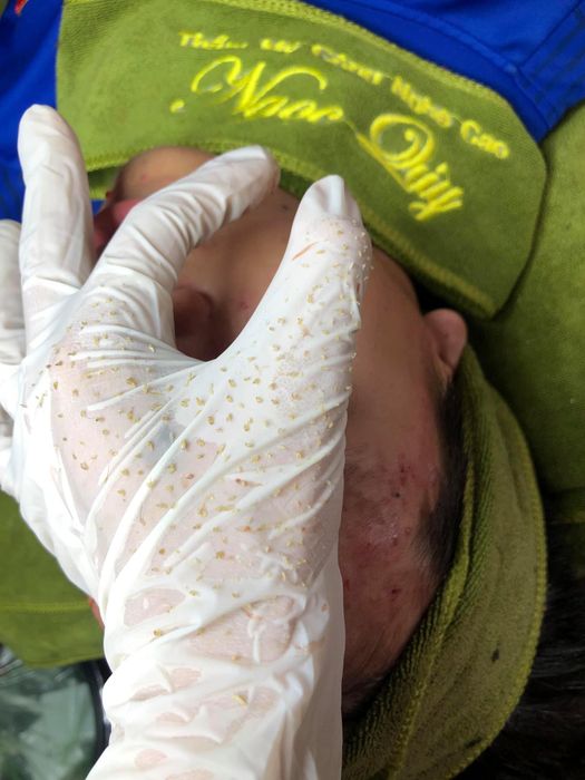 Hình ảnh Thẩm Mỹ Ngọc Quý 1