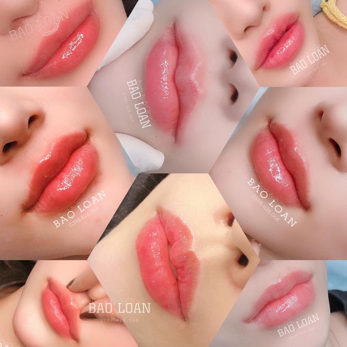 Hình ảnh Bảo Loan Beauty 1