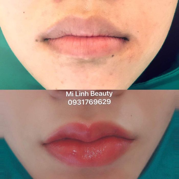 Thẩm Mỹ Mi Linh hình ảnh 2