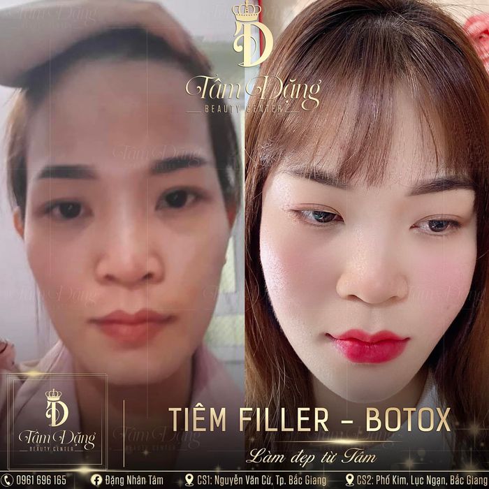 Hình ảnh thứ hai tại Tâm Beauty Center