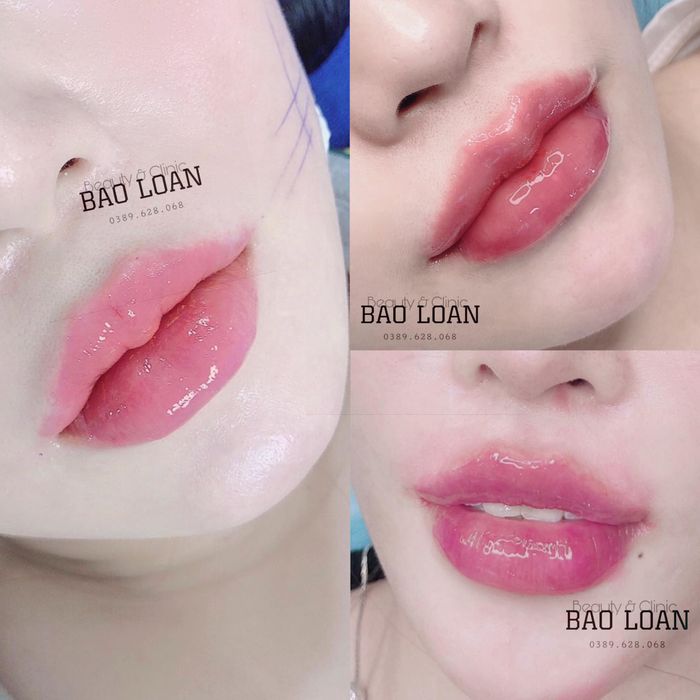 Hình ảnh Bảo Loan Beauty 2