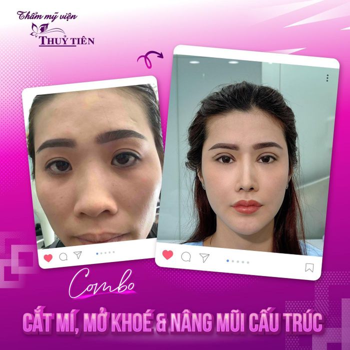 Hình ảnh Thẩm Mỹ Viện Thủy Tiên 1