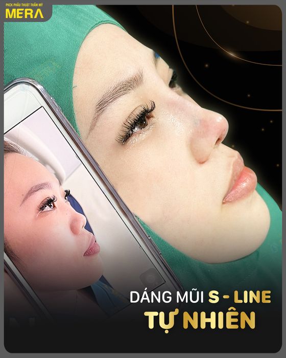 Hình ảnh Phòng khám Chuyên khoa Phẫu thuật thẩm mỹ MERA 1