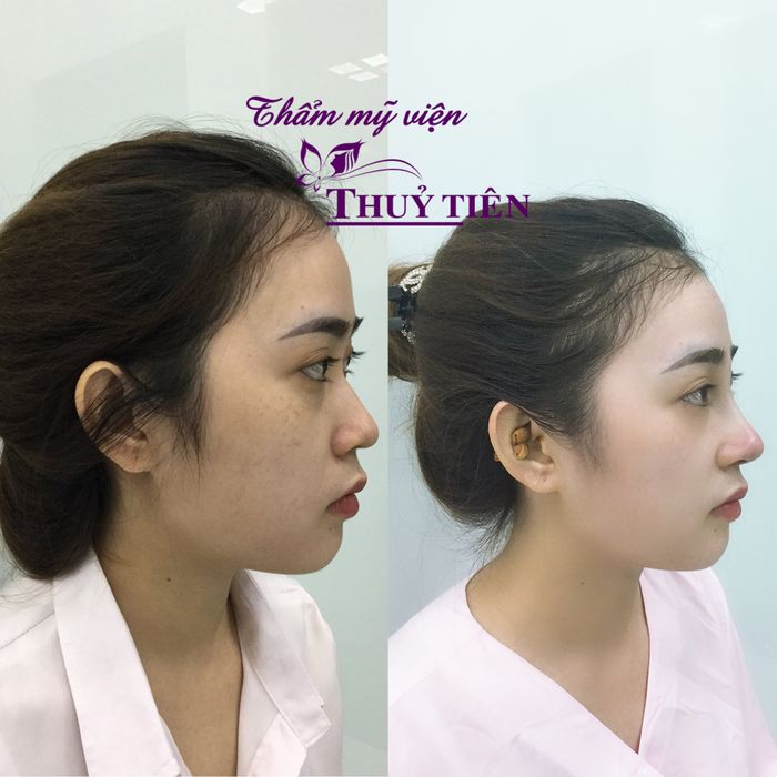 Hình ảnh Thẩm Mỹ Viện Thủy Tiên 2