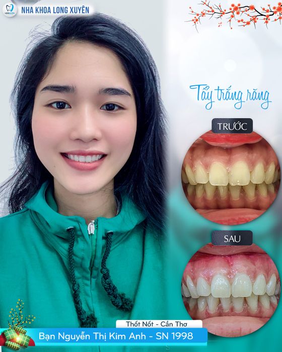 Hình ảnh Nha Khoa Long Xuyên 1