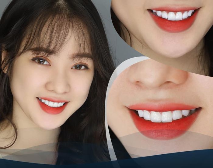 Hình ảnh Nha Khoa AMI 1