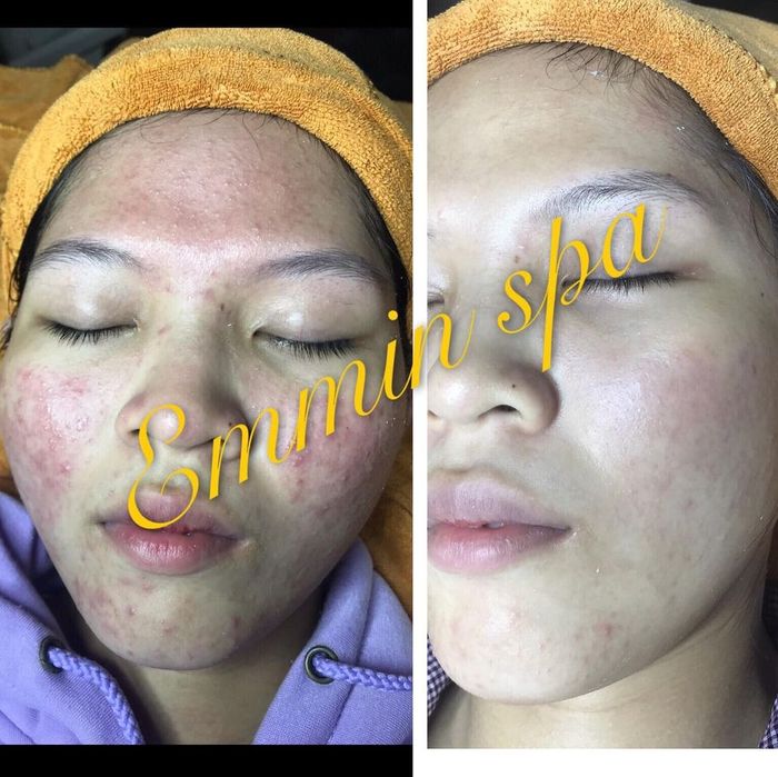 Hình ảnh Emmin Spa số 1