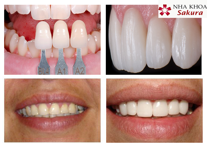 Hình ảnh 2 của Nha Khoa Sakura