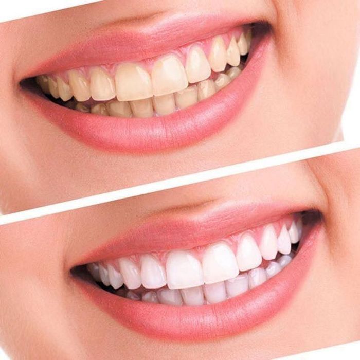 Nha Khoa Dr. Smile Đà Lạt - Hình ảnh 1