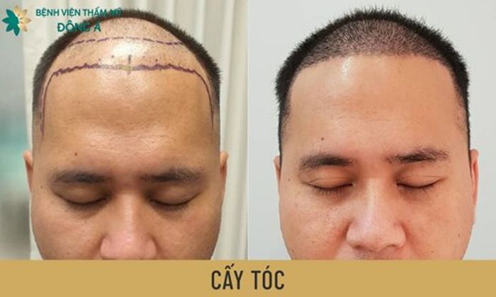 Hình ảnh Bệnh viện Thẩm mỹ Đông Á 2
