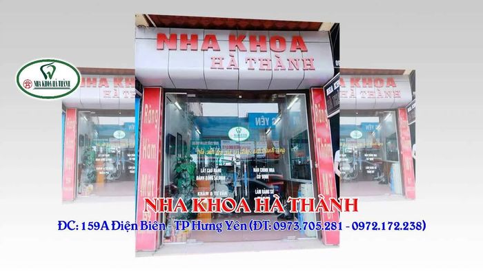 Ảnh Nha khoa Hà Thành 2