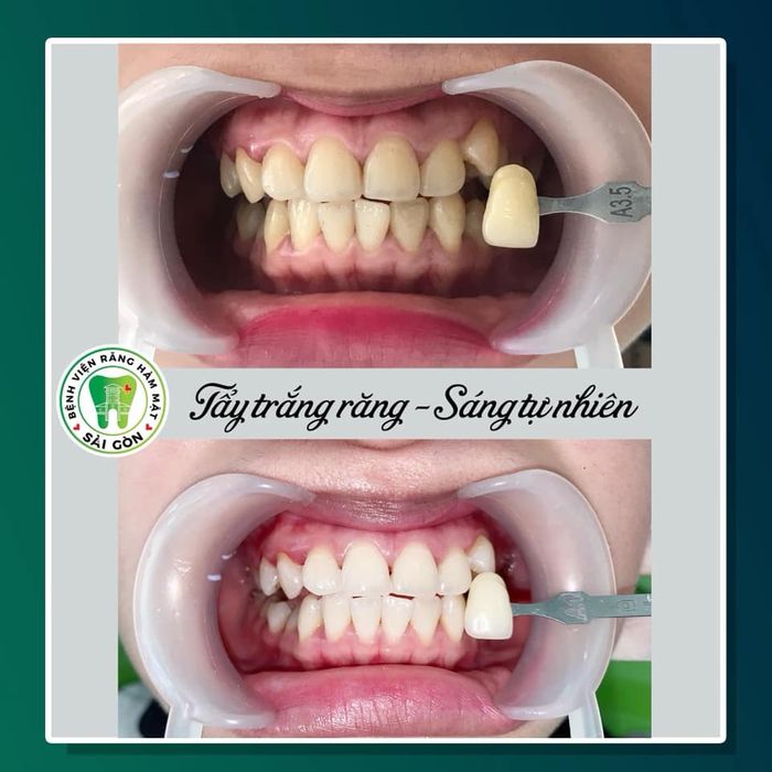 Hình ảnh Bệnh Viện Răng Hàm Mặt Sài Gòn 2