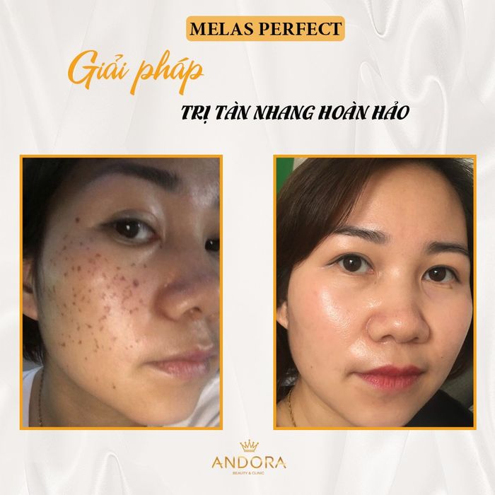 Andora Beauty & Clinic hình ảnh 1