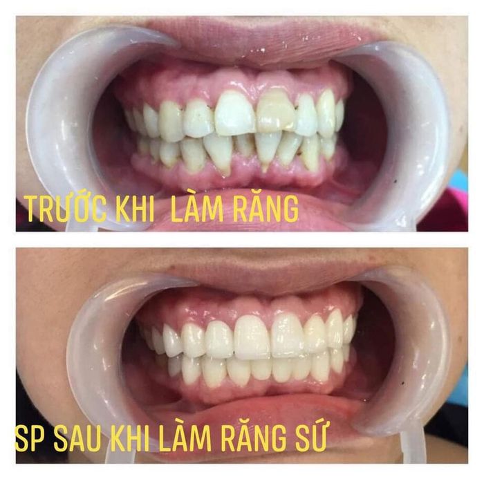 Hình ảnh NHA KHOA KHOA ĐẠT - 1