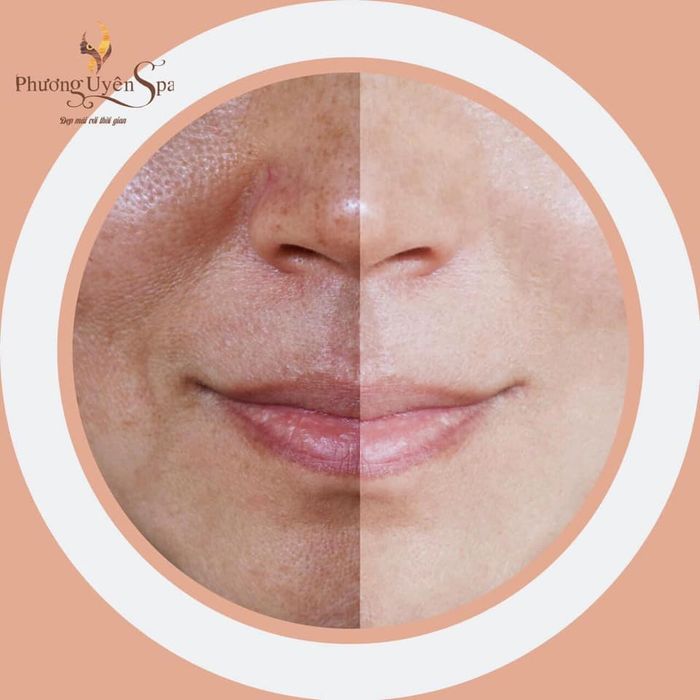 Hình ảnh Phương Uyên Spa 1