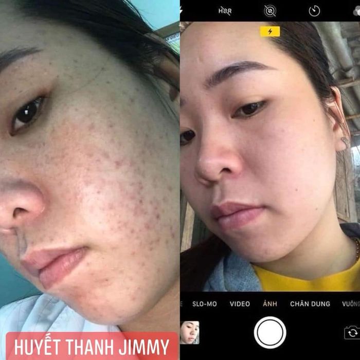 Hình ảnh Trà Beauty Spa 2