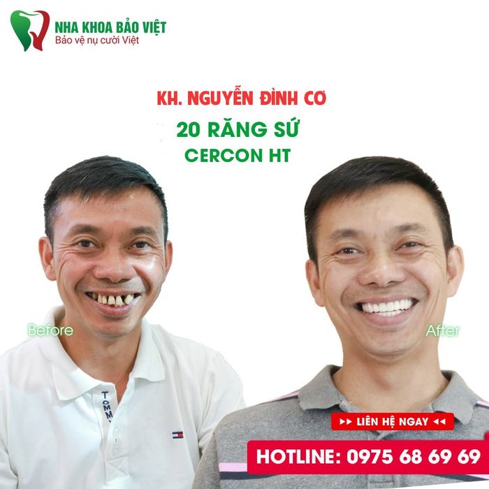Hình ảnh Nha Khoa Bảo Việt 2