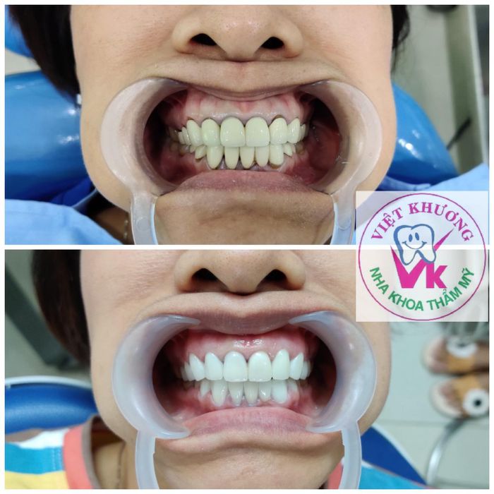 Ảnh Nha Khoa Việt Khương 2