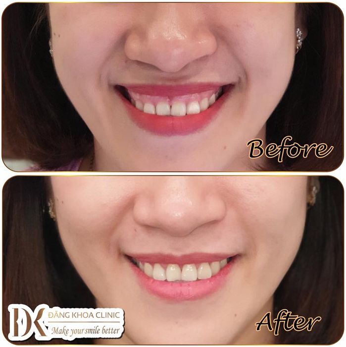 Hình ảnh NHA KHOA ĐĂNG KHOA 2