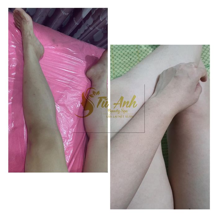Hình ảnh 2 của Spa Tú Anh