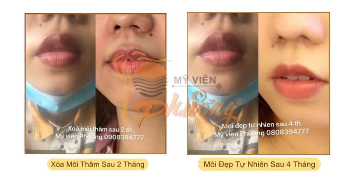 Hình ảnh 2 của Mỹ viện Phương