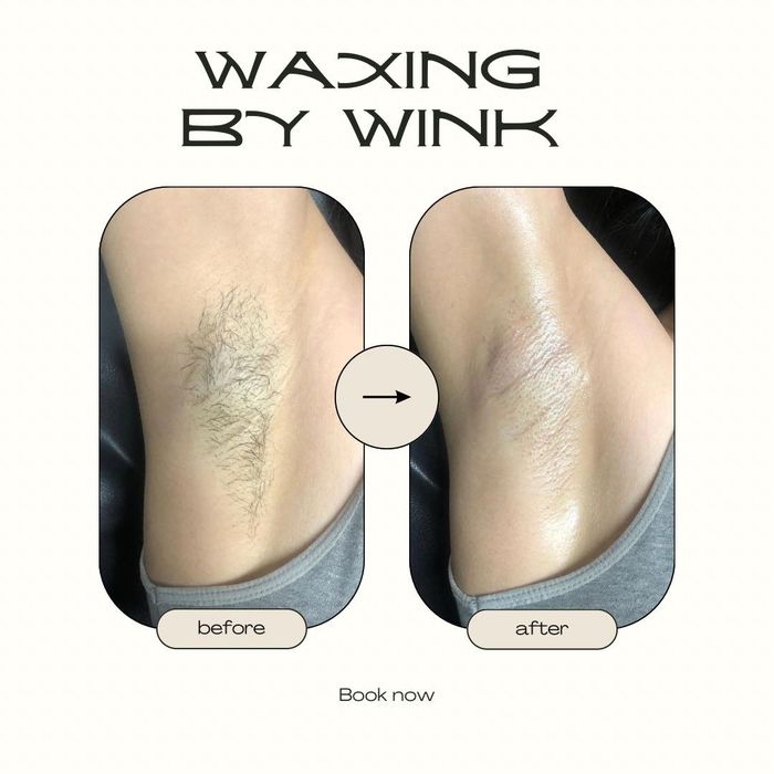 Ảnh 2 của Waxing By Wink
