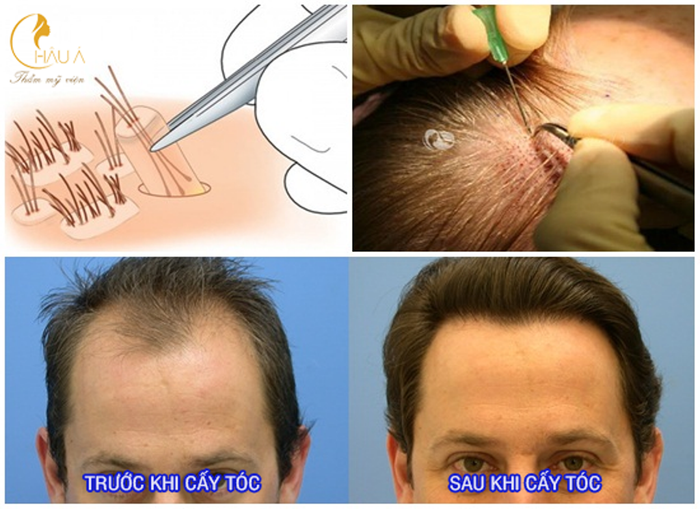 Hình ảnh Thẩm Mỹ Viện Châu Á 1