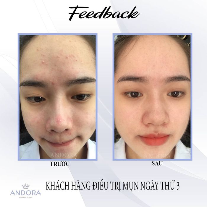 Andora Beauty & Clinic hình ảnh 2