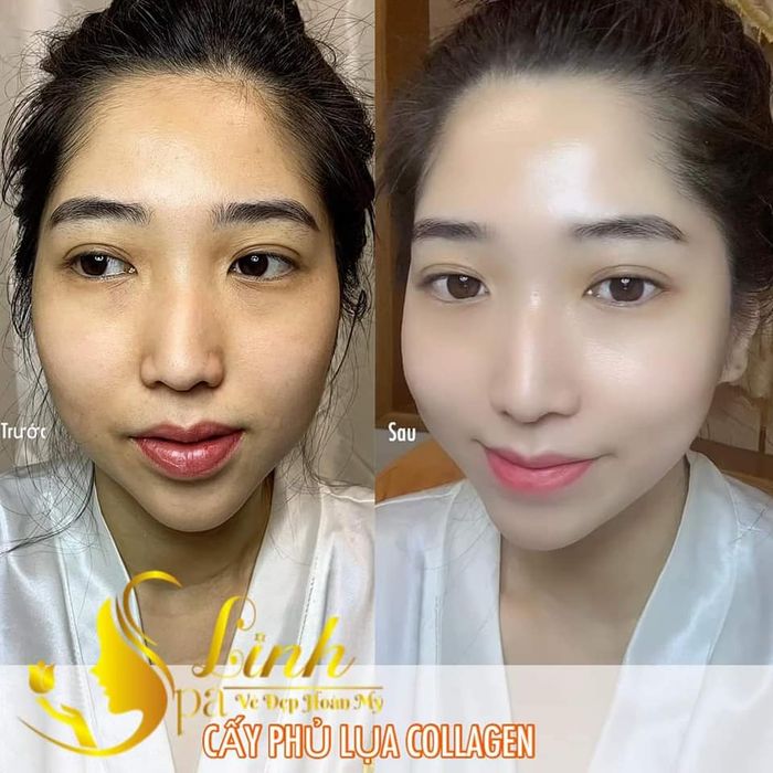 Hình ảnh của Spa Linh 1