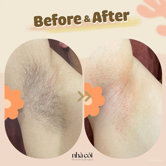 Hình ảnh Nhà Cói Waxing 1