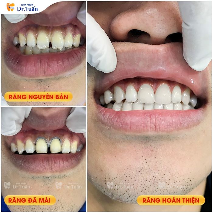 Hình ảnh 2