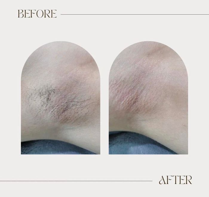 Ảnh 1 của Waxing By Wink