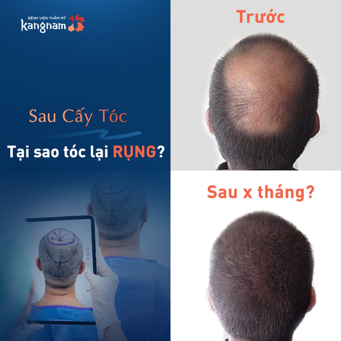 Bệnh viện Thẩm mỹ Kangnam - Hình ảnh 3
