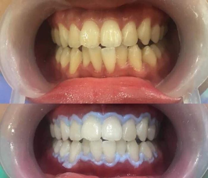 Hình ảnh 1 của Nha Khoa Hoàn Mỹ tại Hải Phòng