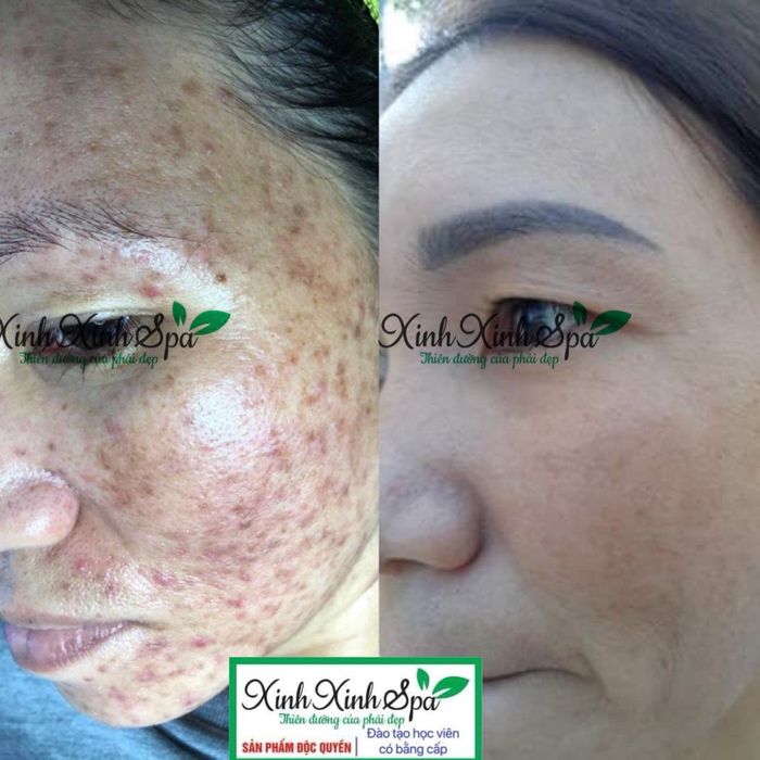 Hình ảnh Xinh Xinh Spa số 1